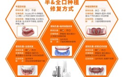 种植牙系统哪个好？品牌如何挑选适合自己的？