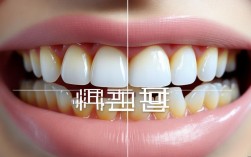 矫正牙齿变黄？最近怎么解决？