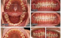 口腔科正畸科图片