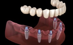 先天性缺牙可以做种植牙修复吗？