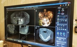 数字化种牙哪家医院能做？求靠谱推荐