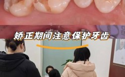 有蛀牙可以矫正牙齿