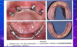cortex种牙效果好不好？适合哪些情况？