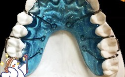 正畸后戴保持器一般要多少钱？
