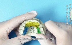 牙齿正畸口腔扩充器