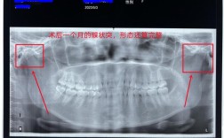 下颌骨X线投照方法的选择与操作要点有哪些？