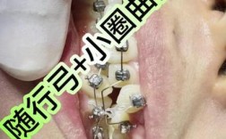 武汉矫正牙齿哪里好