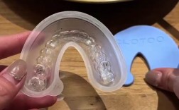 正畸带牙套的食物