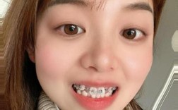 矫正牙齿只拔一颗？拔牙数量少会影响效果吗？