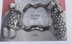 颚杆的作用 正畸