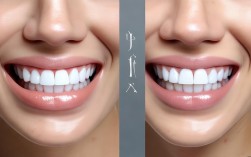 矫正牙齿变形后,牙齿为何会反弹变形?