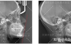 天津口腔医院 正畸