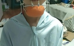 地包天牙齿能矫正吗？矫正方法有哪些？