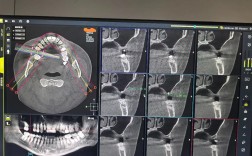 在进行种牙手术时，上颌骨厚度会受到怎样的影响？