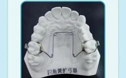 问号弓是什么正畸