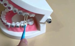 正畸牵引橡皮圈哪里能买到？