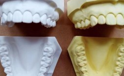 全口缺牙怎么办？有哪些修复方法可选？