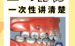 种植钉正畸官网能查到哪些关键信息？