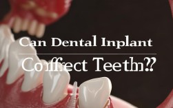 2025年镶牙能矫正牙齿吗？最新方法揭秘