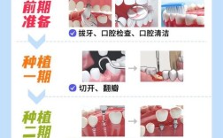 种植牙是怎么种上去的？