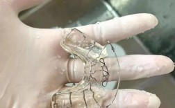 正畸颌垫的制作方法