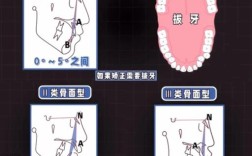 正畸治疗系统一般包括哪些主要组成部分和功能模块？