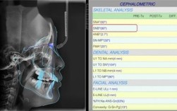 正畸头影测量分析如何辅助正畸精准诊断？