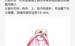 口腔局部麻醉的方法有