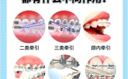 正畸三角垂直牵引法