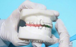 正畸加力的具体方法有哪些？