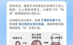 种植牙遇上骨量不足，是先打地基植骨还是直接盖房子种牙？两者的顺序到底该如何科学抉择？