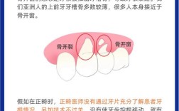 第一磨牙没了如何正畸