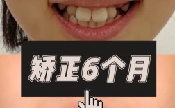 小孩牙齿矫正的最佳年龄是几岁？