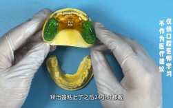 八岁做牙齿正畸扩弓，时机合适吗？效果如何？