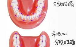 口内扫描的顺序及方法