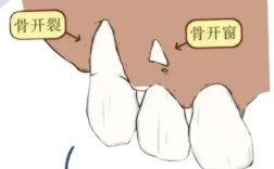 正畸移动前牙牙根的生物学机制是什么？牙根移动方向如何精准控制？