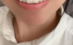 牙齿矫正打骨钉效果究竟如何？真能提升矫正效率与效果吗？