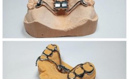 正畸meaw弓的作用是什么？