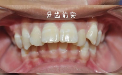 苏州昆山矫正牙齿哪家好？价格效果如何？