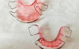 儿童正畸保持器选哪种？不同类型适用情况有何差异？医生建议如何科学选择？