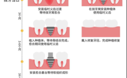 导板植牙是否即种即食