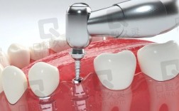 上海拜博口腔植牙价格效果如何？技术靠谱吗？