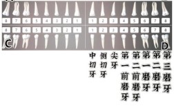 正畸托槽粘接位置数值如何规范把控？