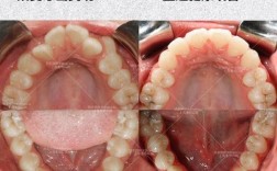 上海去哪里牙齿正畸