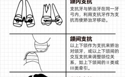 正畸弱支抗方法如何高效实现精准矫治？