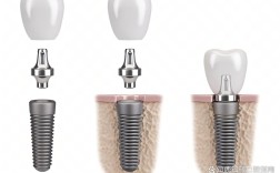 广州种牙那哪里好