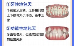 儿童反合矫牙的方法