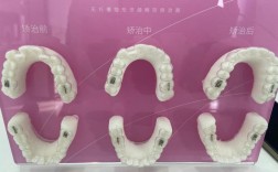 格莱美牙齿隐形矫正效果如何？舒适度和安全性怎么样？