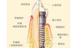 种牙去哪里好？医院医生怎么选？