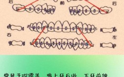 正畸常用的结扎方法有哪些？